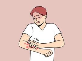 Unhealthy man scratch red pimples on arm suffer from allergy or dermatitis. Stressed unwell guy suffer from itchiness and redness. Healthcare. Vector illustration.