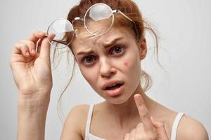 woman with a pimple on the face cosmetology Studio photo