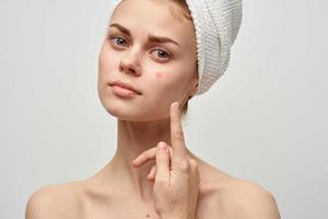 beautiful woman with a pimple on the face cosmetology Studio photo