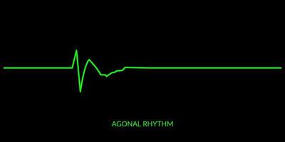 ECG Heartbeat Line. Electrocardiogram vector illustration. Agonal Rhythm