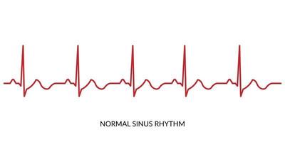 ecg latido del corazón línea. electrocardiograma vector ilustración. normal seno ritmo