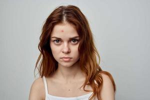 pretty woman with a pimple on the face isolated background photo