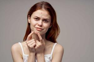 red-haired woman facial skin problems dermatology isolated background photo