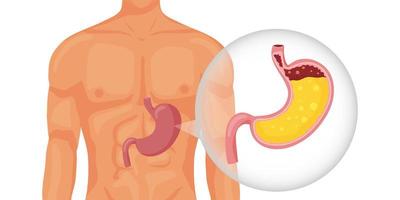 Human stomach full of gastric juice in body vector