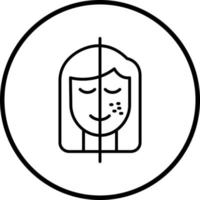 Hyperpigmentation Vector Icon Style
