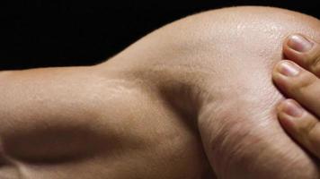 Male stretch marks on the skin of the hands, shoulders and chest close-up video