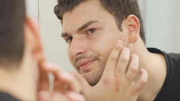 Young man with pimples on his face is unhappy and angry. The man looks at his face in the mirror. video