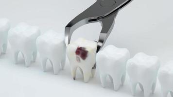 Animation of removing the sick tooth, 3d rendering White tooth video