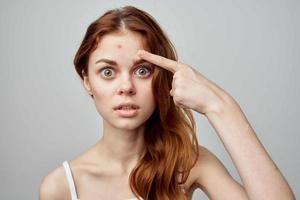 mujer con un espinilla en el cara cosmetología estudio foto