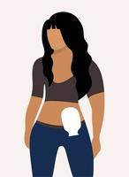 Colostomy bag. Young woman wearing colostomy bag. Vector isolated illustration.