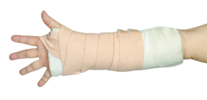 Hand making physical therapy to broken wrist from accident isolated png