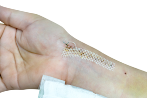 Suture wound on wrist  from accident isolated png