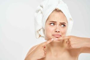 woman with a towel on her head squeezes out pimples on her face clean skin health photo