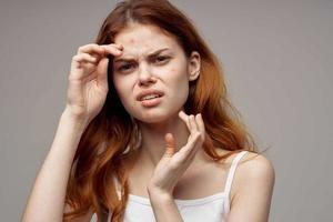 bonito mujer facial piel problemas dermatología de cerca foto