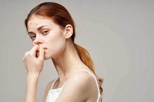 red-haired woman with pimples on the face hygiene isolated background photo