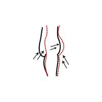 abdominoplasty, woman vector icon