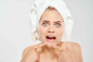 woman with a towel on her head squeezes out pimples on her face clean skin health photo