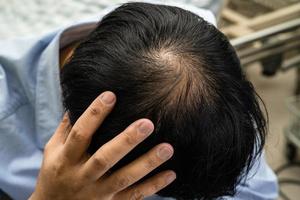 calvo en la cabeza media y sin pérdida de cabello glabro de hombre de oficina activo inteligente de negocios asiáticos maduros. foto