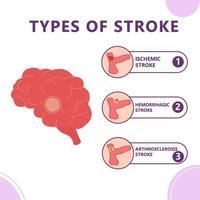 Infographic of types of brain stroke vector