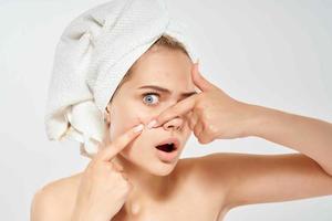 pretty woman with a towel on her head squeezes out pimples on her face skin care problems photo