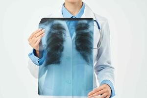 doctor in a white coat x-rays of the lungs research work photo