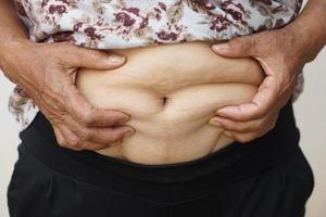 de cerca mujer manos toque grande barriga, grasa con celulitis abdomen. concepto, obesidad. exceso de peso. cuerpo forma problema para mujer después el embarazo o consiguiendo más viejo. brezo cuidado. foto