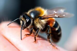 bee stung on the finger photo