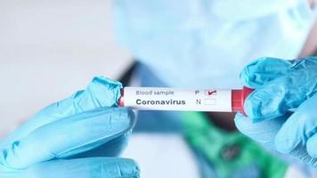 main dans latex gants en portant HIV du sang tester tube video