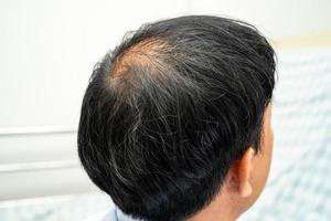 Bald at front of head and begin no loss hair glabrous of mature Asian business smart active office man. photo