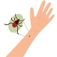 The human hand with  the tick bite. Tick bite hand.Tick bite.  Healthcare illustration. vector
