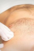 Young caucasian man receiving hair removal from his chest in a beauty salon, depilation men's torso. photo