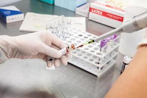 científico preparando muestras para fluir citométrico análisis en el laboratorio. cáncer diagnóstico foto