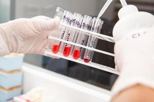 Scientist preparing bone marrow samples for flow cytometric analysis in the laboratory. photo