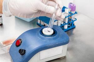 Scientist preparing samples for flow cytometric analysis in the laboratory. Mixing sample using a vortex. Cancer diagnosis photo