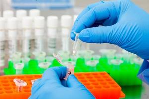 Closeup of scientist hands while extracting DNA using the spin column-based nucleic acid purification technique photo