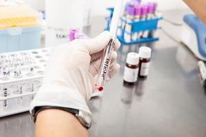 Scientist preparing bone marrow samples for flow cytometric analysis in the laboratory. photo