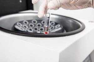 Test tube with bone marrow cells pellet obtained after centrifugation. Scientist preparing bone marrow samples for flow cytometric analysis in the laboratory. photo