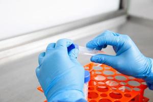 Young female scientist working in a safety laminar air flow cabinet at laboratory photo