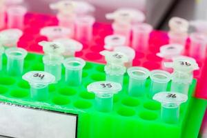 Rack of test tubes being used for DNA extraction using the spin column-based nucleic acid purification technique photo