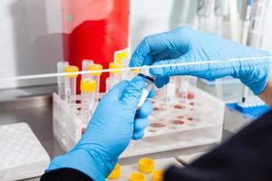 Scientist preparing blood samples for karyotipe and fluorescence in situ hybridization in the  laminar air flow cabinet. Blood sample preparation for diagnosis. Blood test. photo