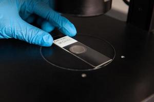 Scientist looking at slides with patient samples using an inverted microscope in the laboratory. Fluorescence in situ hybridization technique. photo