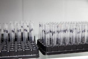 Group of test tubes containing patient samples ready for flow cytometry analysis. photo