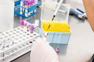 Scientist preparing bone marrow samples for flow cytometric analysis in the laboratory. photo