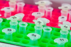 Rack of test tubes being used for DNA extraction using the spin column-based nucleic acid purification technique photo