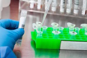 Closeup of a scientist extracting DNA using the spin column-based nucleic acid purification technique. Spin column-based nucleic acid purification technique. Diagnosis of human papillomavirus virus. photo