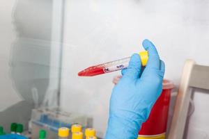 Scientist preparing blood samples for karyotipe and fluorescence in situ hybridization in the  laminar air flow cabinet. Blood sample preparation for diagnosis. Blood test. photo