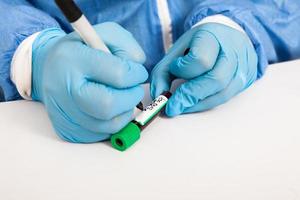 Closeup of a nurse labelling a test tube with blood sample in a clinical laboratory photo