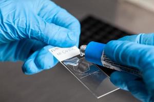 Scientist applying glue to the laboratory slide cover glass. Scientist preparing slides for karyotipe and fluorescence in situ hybridization - FISH in the laboratory. photo