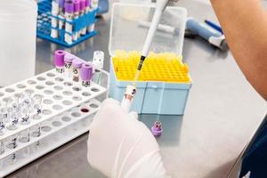 Scientist preparing bone marrow samples for flow cytometric analysis in the laboratory. photo