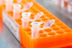 Rack of test tubes being used for DNA extraction using the spin column-based nucleic acid purification technique photo